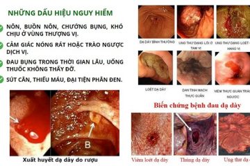 ĐẠI TRÀNG BONIBAIO CÓ CÔNG GÌ MUA Ở ĐÂU
